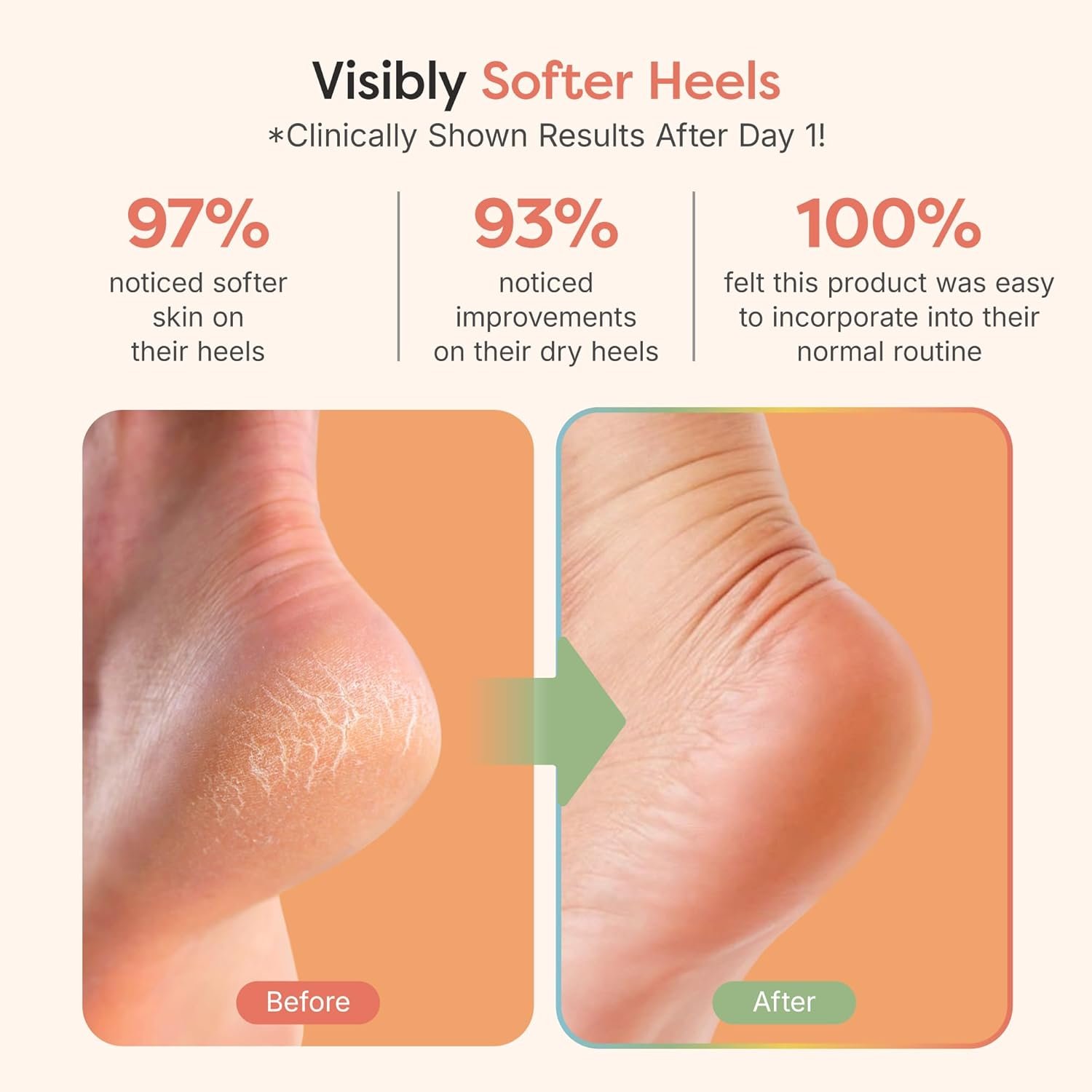 ZenToes Moisturizing Socks for Cracked Heel Treatment - Vitamin E, Olive Oil and Jojoba Oil Infused Heel Socks to Soften and Hydrate (Fuzzy Pink, Regular) - Image 4